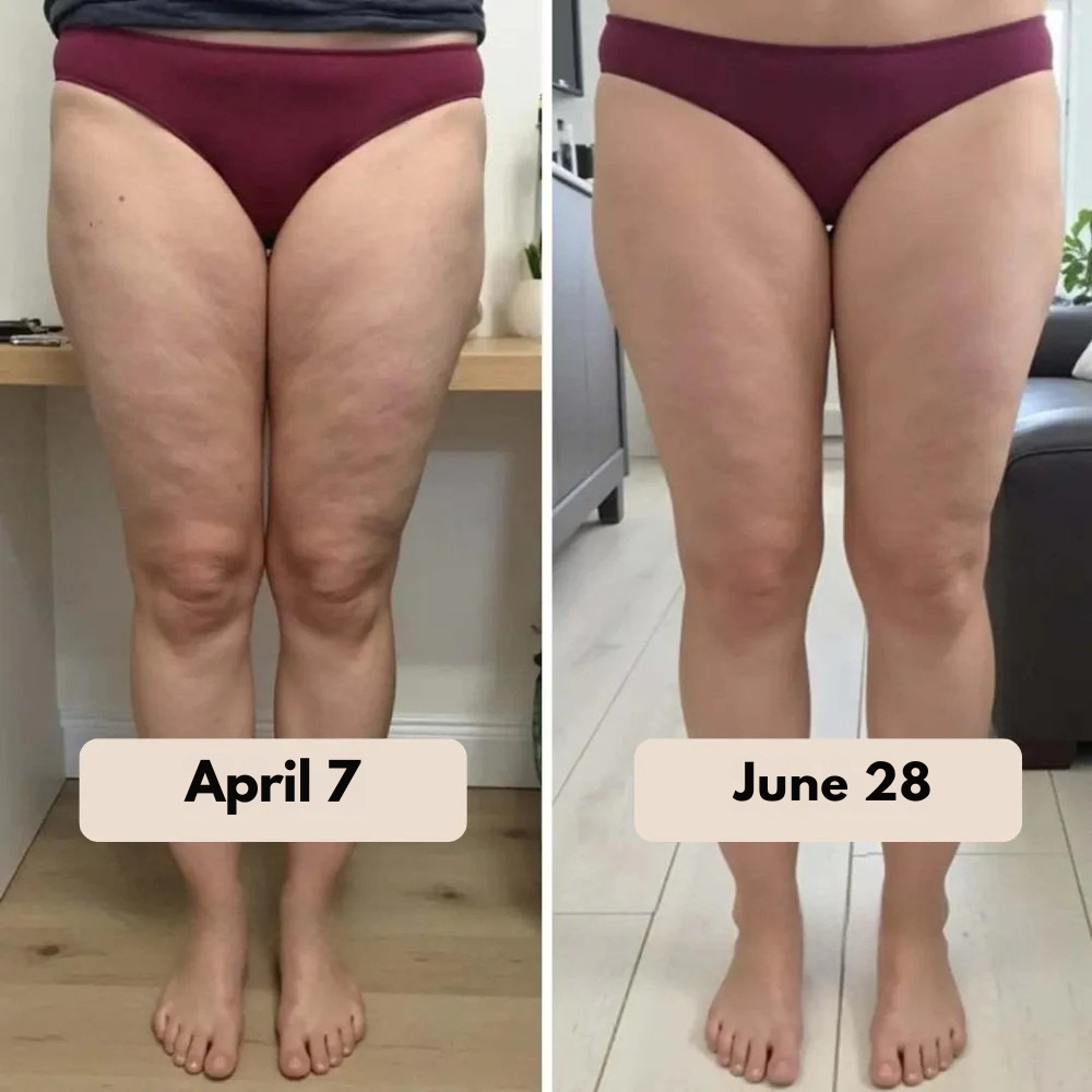3D Shaping Leggings | Reduces Cellulite & Slims the Waist